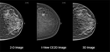 Turn the invisible into the visible with I-View™ Contrast Enhanced Imaging